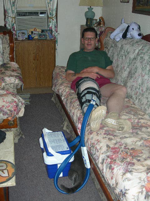 Leg brace after the ACL surgery
